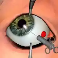眼科手术学电子版